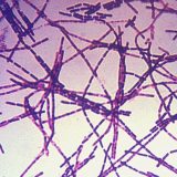 Epidemija antraksa u zapadnom Sibiru? 1