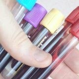 Preventivni pregledi najbolji način sprečavanja oboljenja 8