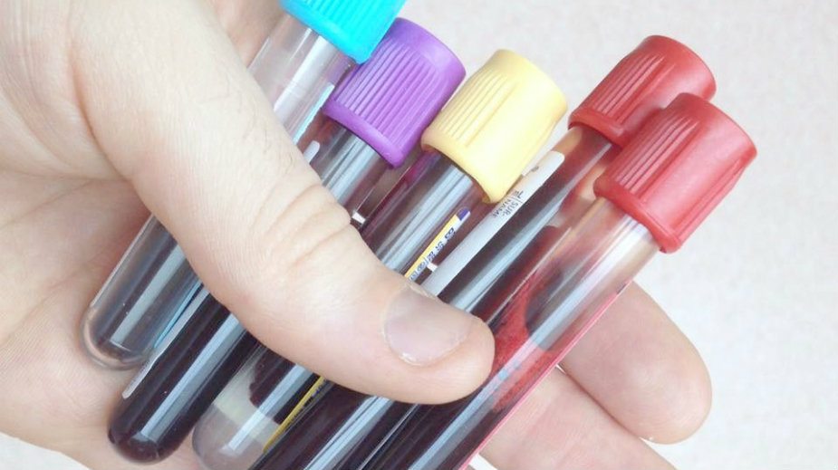 Preventivni pregledi najbolji način sprečavanja oboljenja 1