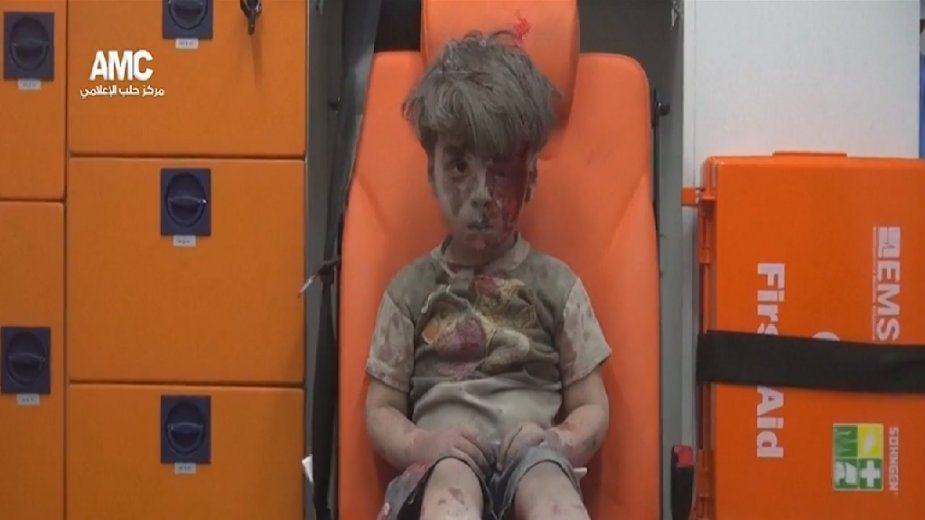 Dečak iz Alepa: Kad završi rat počistiću ulice 1