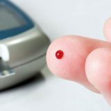 Za veći pristup inovativnim terapijama 9