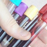 Kod privatnog lekara sa zdravstvenom knjižicom 11