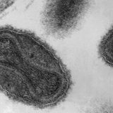 Torlak potvrdio da je petoro zaraženo malim boginjama 10