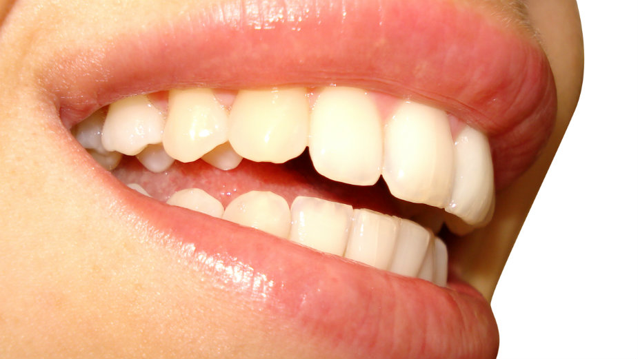 Devet prirodnih načina za izbeljivanje zuba 1