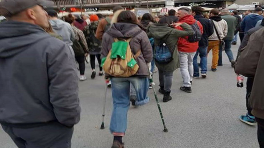 Hrabra Gorica dobija novu protezu 1