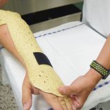 Za saniranje preloma kostiju biološki razgradiv gips 1