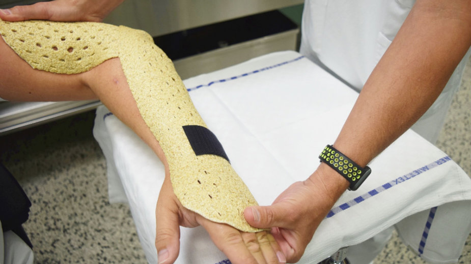 Za saniranje preloma kostiju biološki razgradiv gips 1 Za saniranje preloma kostiju biološki razgradiv gips 1