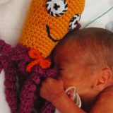 Hobotnice pomažu preveremeno rođenim bebama (VIDEO) 10