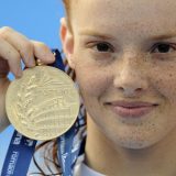 Nađa Higl: Bolujem od teške, autoimune bolesti 4