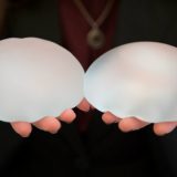 Na akcijama i plastične operacije 5