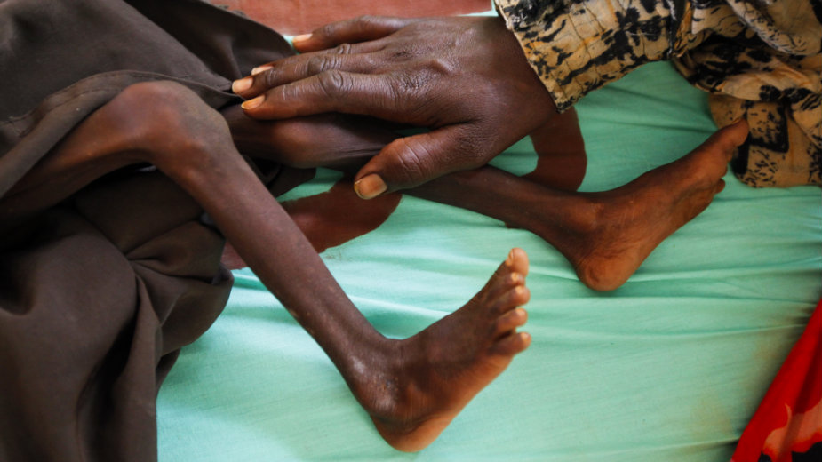 Raste broj gladnih u svetu, bez hrane 815 miliona ljudi 1