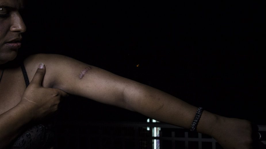 Život i smrt LGBT izbeglica u Grčkoj i Turskoj 5