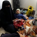 Zarazne bolesti šire se Jemenom 7