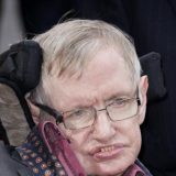 Čovek koji je imao samo mozak 3