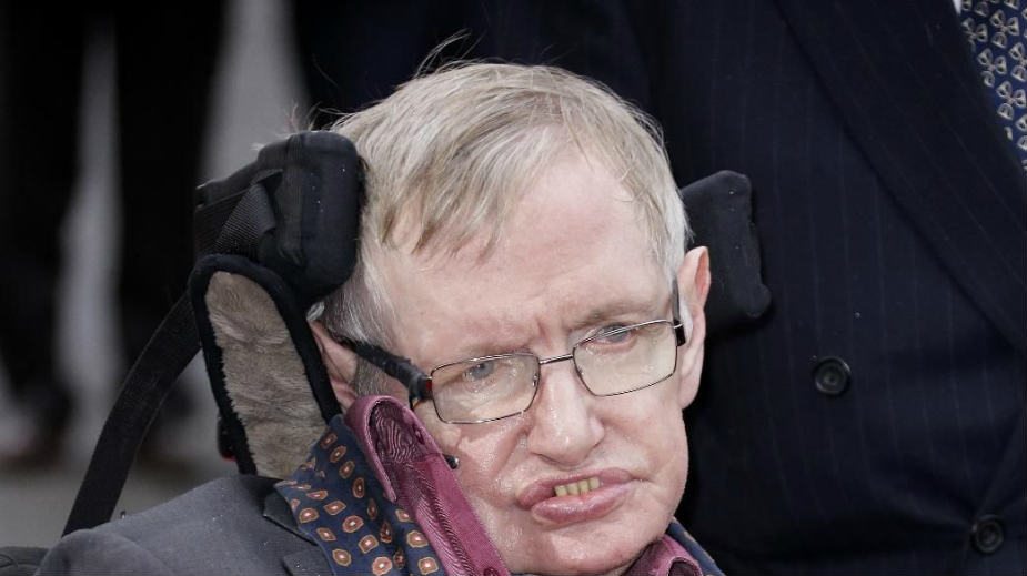 Čovek koji je imao samo mozak 1