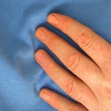 Koji su najčešći uzročnici smrti u zemljama EU? 12