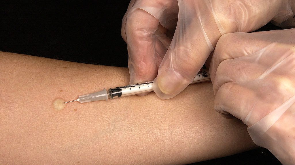 Tuberkuloza deveti uzročnik smrti u svetu 1