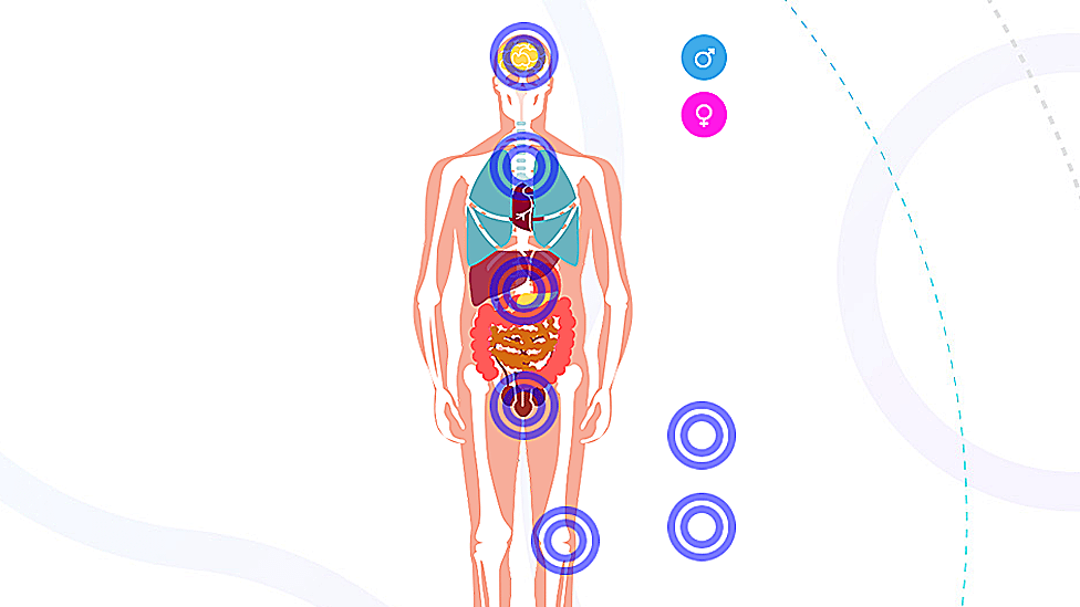 Studentski sajt o kanceru koju koristi sve veći broj pacijenata 1 Učenje o tumorima po sistemu organa
