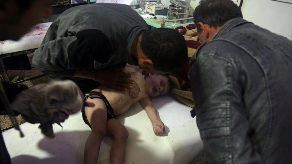 Dete dobija terapiju u bolnici nakon navodnog napada hemijskim oružjem (7. april 2018)