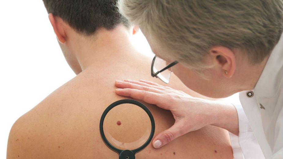 Besplatni pregledi za prevenciju raka kože 1