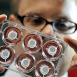 Za retke bolesti 25 inovativnih terapija u Srbiji, u Sloveniji pet puta više 4