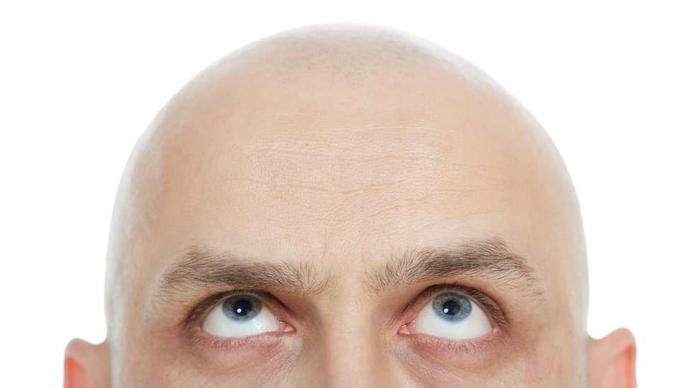 Na pomolu lek protiv ćelavosti 3 Ćelavko