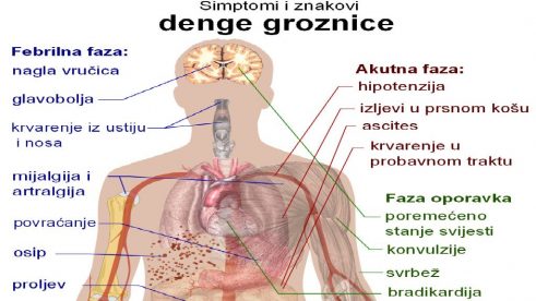 SZO: Moguće širenje denga groznice 2