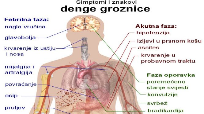 SZO: Moguće širenje denga groznice - Život - Dnevni list Danas