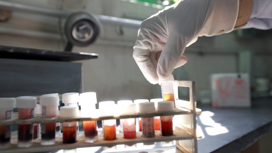 Niska stopa testiranja na HIV u CG 1