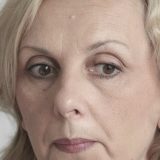 Buniti se u dubokoj rupi 10