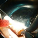 Danski naučnici: Imamo lek za erektilnu disfunkciju 2