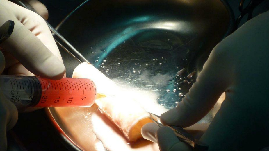 Danski naučnici: Imamo lek za erektilnu disfunkciju 1