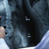 Otkazan protest medicinskih radiologa 3