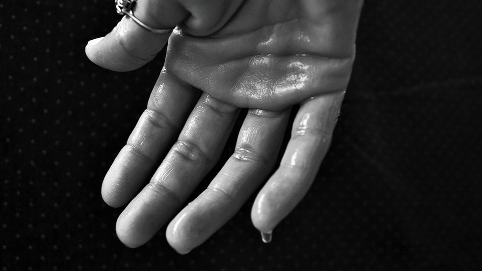 Koji su uzroci prekomernog znojenja? 1