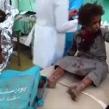 Rat u Jemenu: Deca stradala u napadu na autobus 8