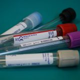 Naučnici pretvorili krvnu grupu A u 0 8