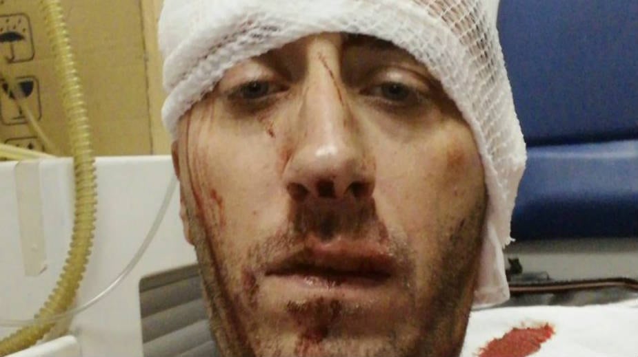 Pretučeni novinar BN TV zabrinut za porodicu 1 Pretučeni novinar BN TV zabrinut za porodicu 1