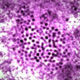 Batut: Od groznice Zapadnog Nila umrlo 29 ljudi u Srbiji 8