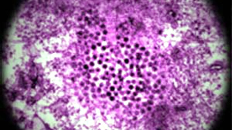 Batut: Od groznice Zapadnog Nila umrlo 29 ljudi u Srbiji 1