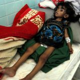 Milioni dece gladuju u Jemenu 3