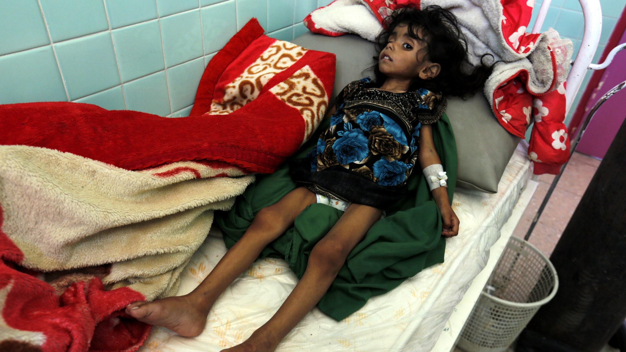 Milioni dece gladuju u Jemenu 1