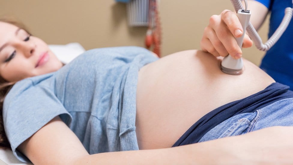 Pregnant woman getting an ultrasound