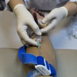 U Srbiji 2.562 ljudi inficirаno HIV-оm 3