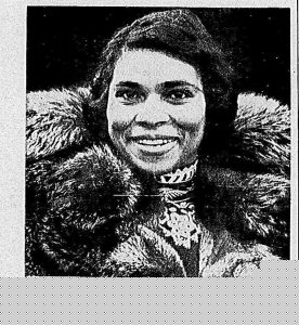 Šminkanje kolena nova moda u Holivudu 3