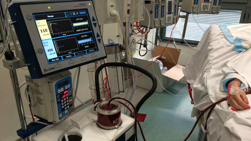 AKIS: Srbiji terbaju nacionalni centri za ECMO u borbi sa virusom H1N1 1