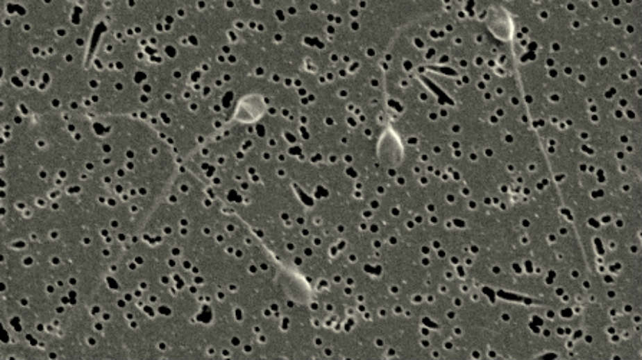 Kako žensko telo „blokira“ slabe spermatozoide 1