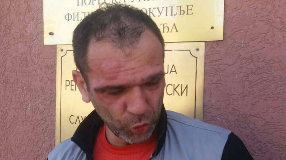 Ukinut pritvor trojici osumnjičenih za prebijanje predsednika opštine Žitorađa 1