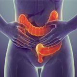 Svake godine 4.500 novoobolelih od raka debelog creva u Srbiji 3