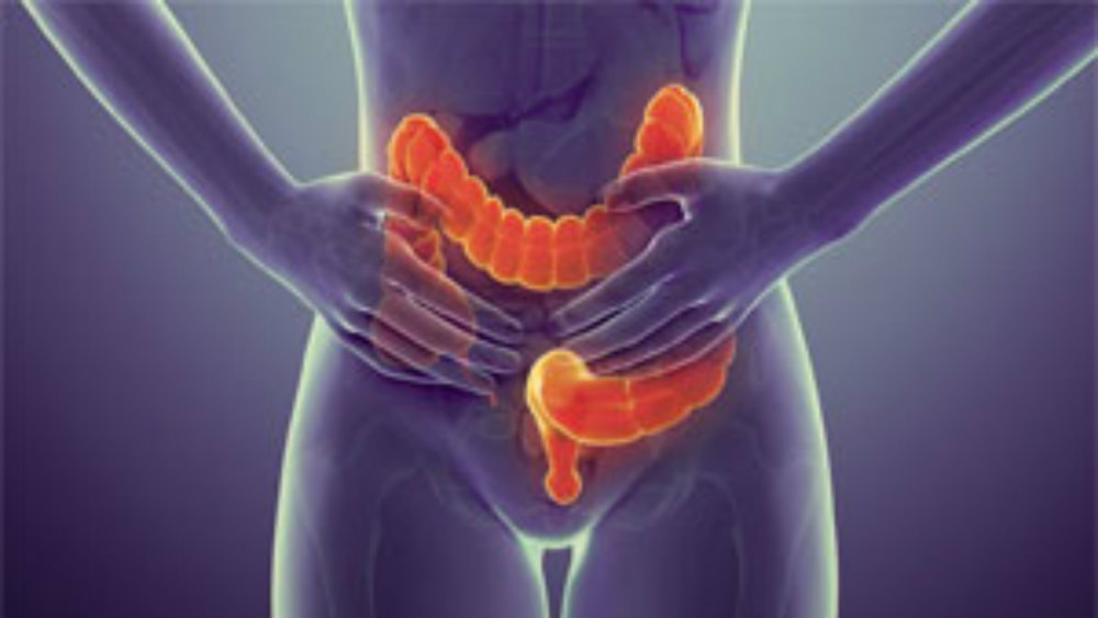 Svake godine 4.500 novoobolelih od raka debelog creva u Srbiji 1