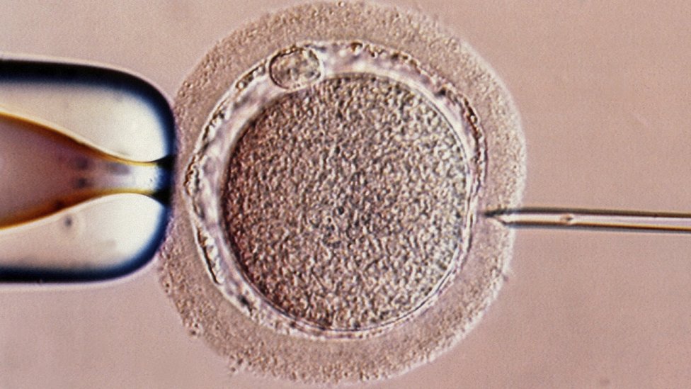 File image of IVF